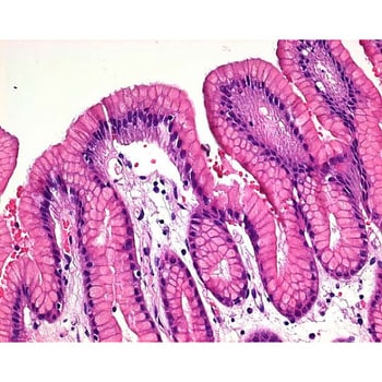 苏木精一水合物 CI 75290 用于显微镜 Thirtystain 115938 100GMerck(默克密理博)1.15938.0100